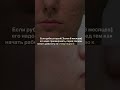 КАК УБРАТЬ РУБЦЫ??