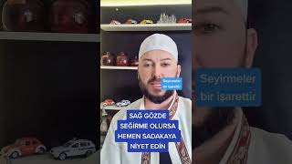 Sağ Gözde Seği̇rme Olursa... Üysüz