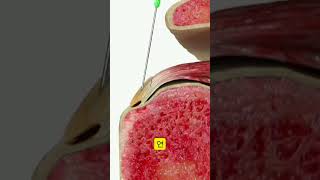 회전근개 파열, 수술이 두렵다면? '83% 재생 효과' PRP 주사 정리 💉#회전근개파열 #PRP주사2026