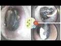 【耳そうじ】Vol. 39耳垢は溜めるのではない、貯めるのだ!earcleaning & headmassage