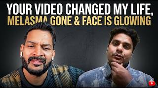 Your video changed my life, Melasma gone & face is glowing