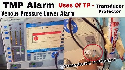 Venous/TMP Alarm during Hemodialysis Use of TP(Transducer Protector) / Prevention of dialysis Access