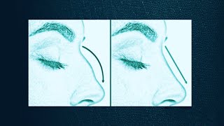 Belle Femme - Vol. 2 - Rhinoplasty - Ideal Female Nasal Geometry Subliminal Morphic Field
