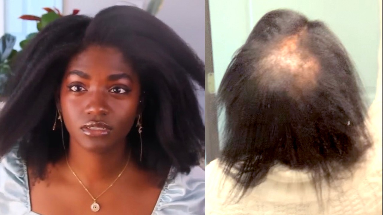 my hair fell out. again.