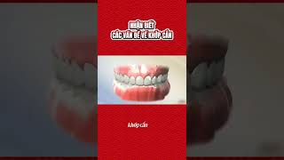 NHẬN BIẾT CÁC VẤN ĐỀ VẾ KHỚP CẮN #nhakhoaadona #nhakhoauytin #khopcan #viral #rangmieng #xuhướng