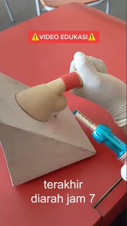 Fivian GHC - Proses Tindakan Anestesi Free Needle Injector pada metode Sunat Modern Supering