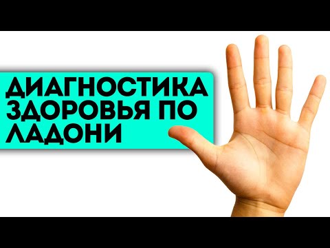 Давно смотрел на свои ладони? Беги в больницу, если заметишь на ладонях эти признаки