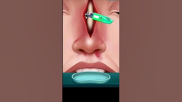 Nose 👃 Surgery #doctor #games #nose