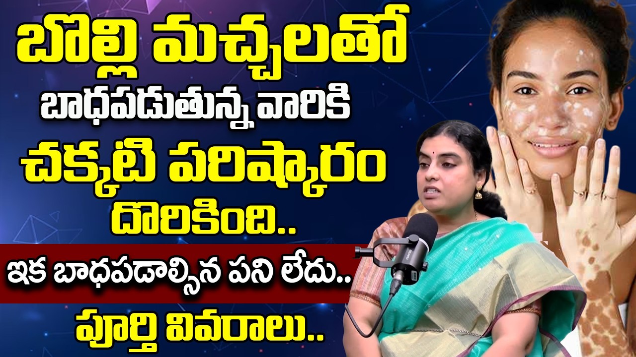 తెల్లమచ్చలు బొల్లి మచ్చలు పోవాలంటే | Home Remedies for White Patches on Skin | @BRK WOMEN HEALTH