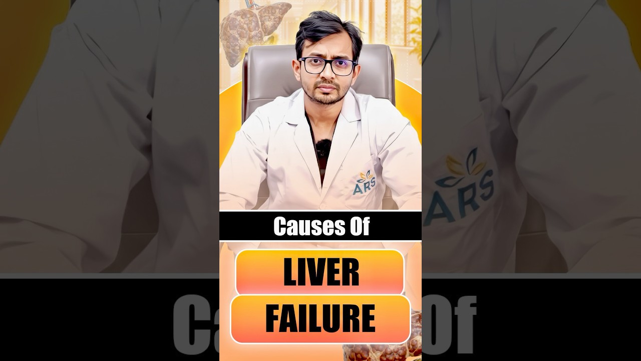 What Causes Liver Failure? | #liverfailure #shorts #gastroenterology #trending