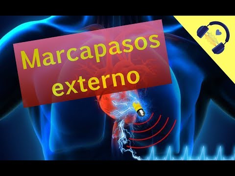 Marcapasos transcutaneo 🎧