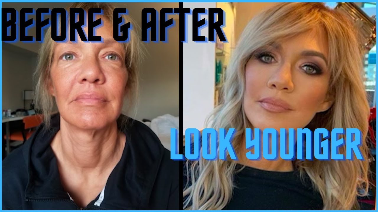 Do Facelifts Ever Look Natural?