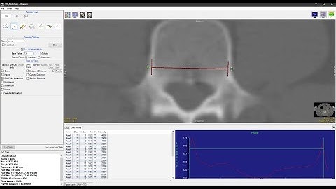 Analyze 14.0 - Measure: Sample Lines FWHM measurements
