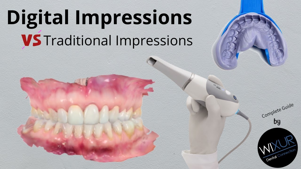 Digital vs. Traditional Impressions; The New Innovations YouTube