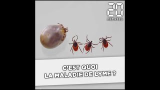 C'est quoi la maladie de Lyme ?