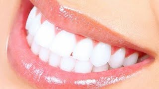 ثلاث خلطات او وصفات طبيعية لتبيض الأسنان ???