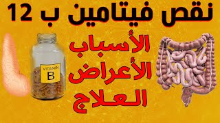 فيتامين بي 12- فوائده , نقص B12 واسبابه واعراضه و علاجه ( ب12)