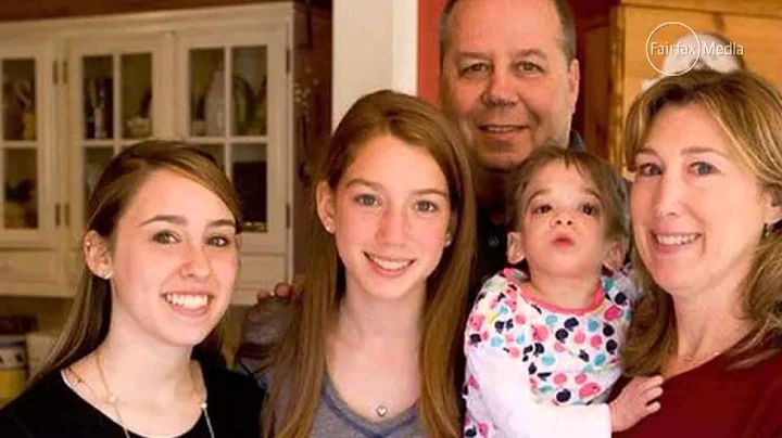 Brooke Greenberg dies while suffering Syndrome