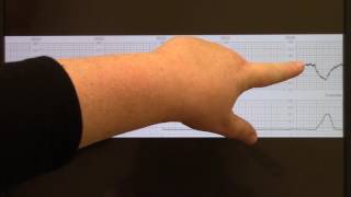 Variable Deceleration