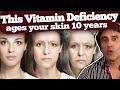 THIS ONE VITAMIN DEFICIENCY WRINKLING YOUR FACE // Vitamins for Skin