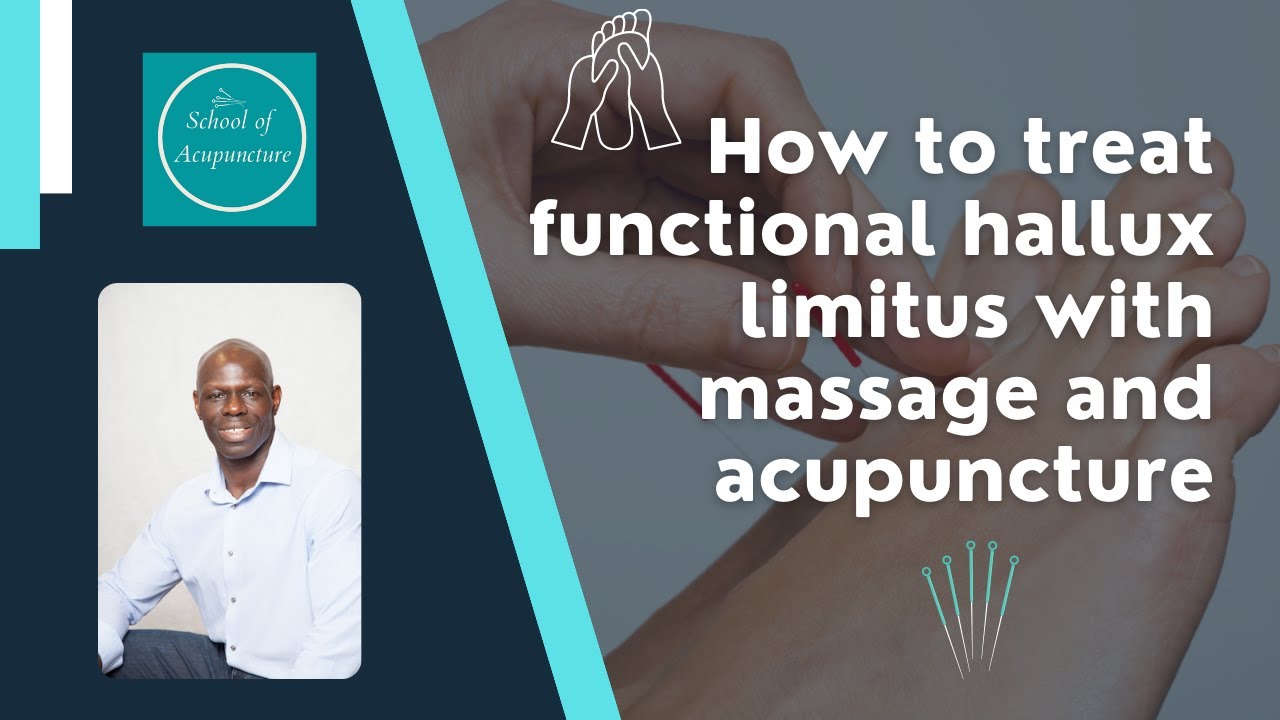 How to treat functional hallux limitus with massage, myofascial release and acupuncture
