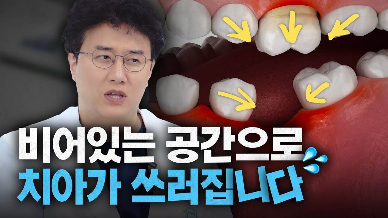 어금니 발치 후 방치하면 생기는 일 - YouTube