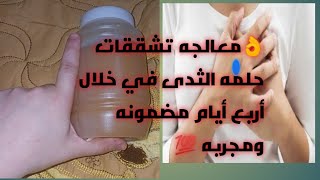 وصفه# لتشققات حلمت الثدي وعلاج في خلال أربع ايام باذن الله وهتدعيلي