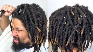 He has PAINFUL SCALP FLAKES *TRANSFORMATION*