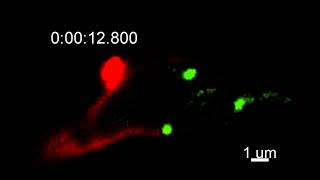 Video S11 Dynamic tracking of retromer complex subunit MoVps35 transport to the BIC-associated zone.