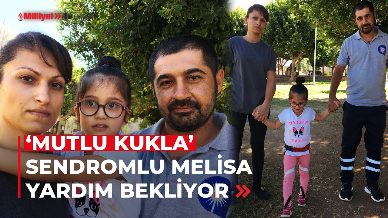 'Mutlu Kukla' sendromlu Melisa yardım bekliyor