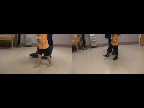 Before & After | Mild Knee Hyperextension | JumpStart Softback