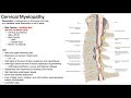 Cervical Myelopathy | Presentation, Risk Factors, & Signs/Symptoms