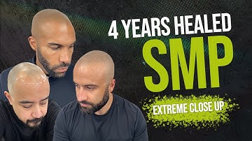 The Truth About Healed SMP Results