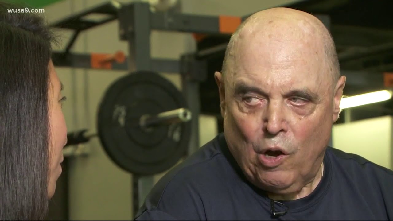 Boxing class helps people with Parkinson's disease