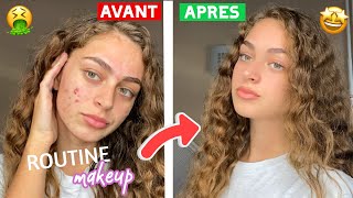 ma routine makeup d’acnée