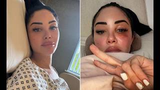 Tulisa hit by Bell’s palsy, cancels procedure in health update【News】