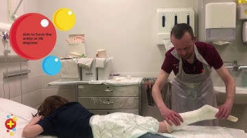 How to...apply a below knee POP