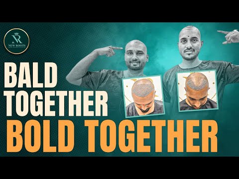 Two Best Friends Undergo Hair Transplant Together 😀 | Nagpur | New Roots