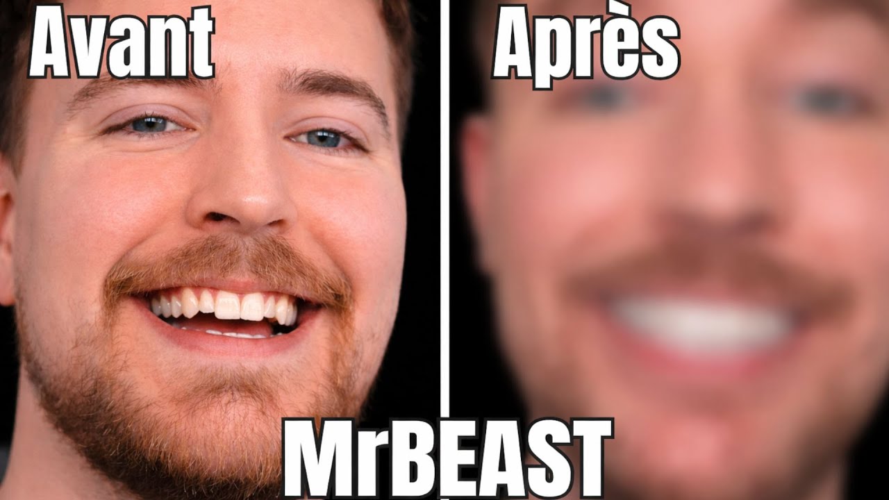 Pourquoi MrBeast a fait ça ? Son incroyable transformation enfin expliquée
