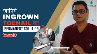 Ingrown Toenail  Surgery  | Nail Surgery  Clinic in Delhi| Ingrown Toenail Removal in Delhi SkinQure