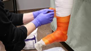 Casting Class, Lower Extremity: Foot/Ankle