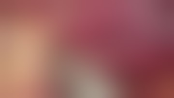 laparoscopic caudate lobe resection