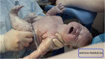 O que causa asfixia neonatal?