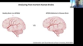 Faculty Forum Online: Lowering a Barrier to Understanding Alzheimer’s screenshot 5