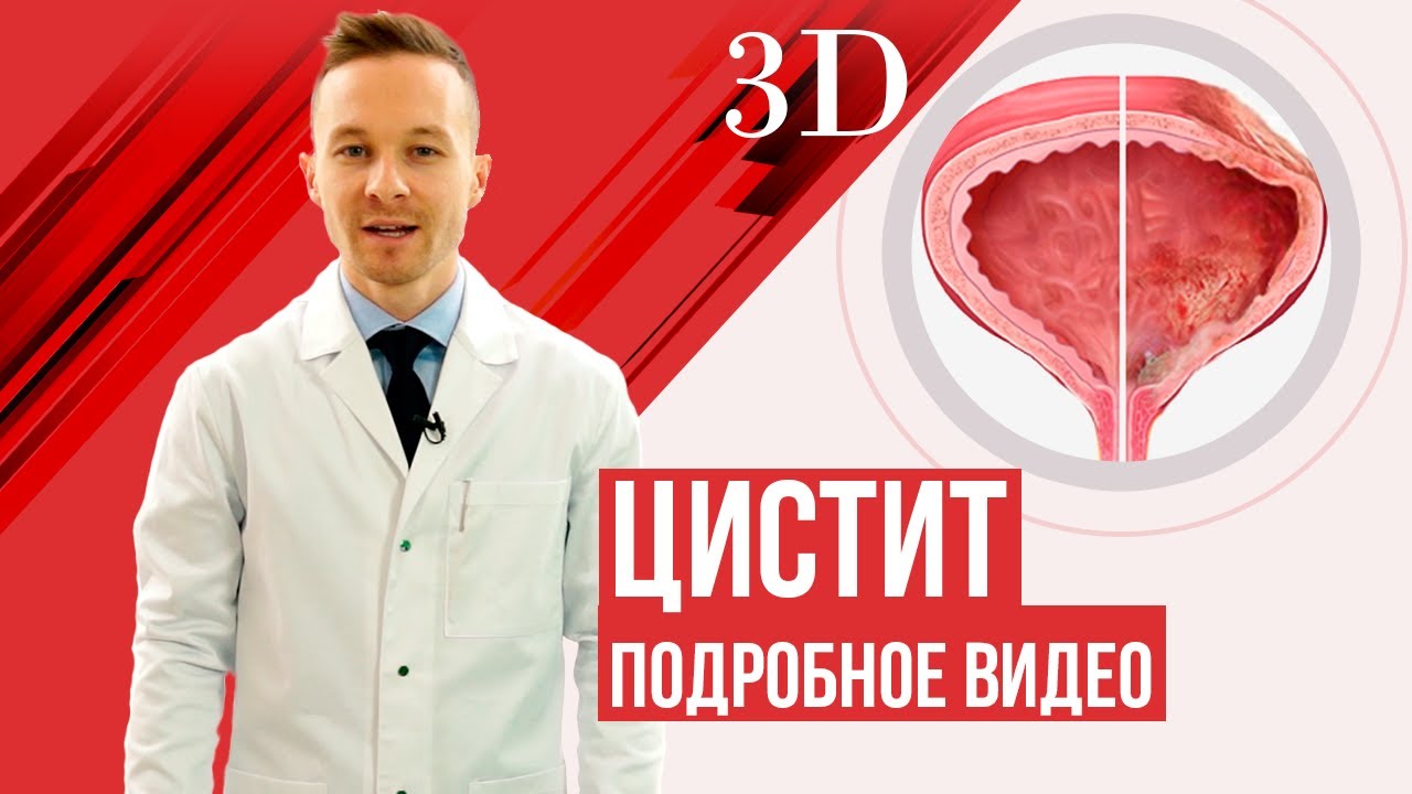 Цистит, лечение у женщин.  Почему не стоит лечить цистит в домашних условиях?
