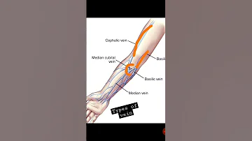 Types Of Vein Shorts Info 