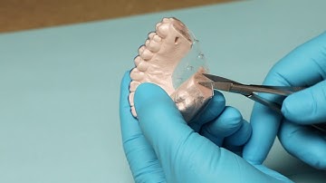 How To Create Custom Trays | Opalescence™ PF