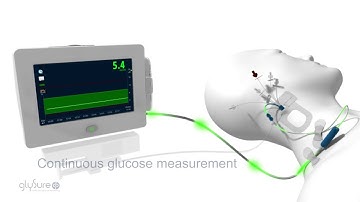GlySure™ | Continuous Glucose Monitoring System - Marketing Film