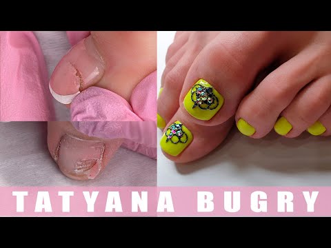 Fixing my BROKEN Toenail | Summer Pedicure | Doing your own Pedicure at home |Russian Efile Pedicure