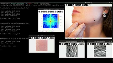 Blemish Removal | OpenCV University | Computer Vision Fundamentals